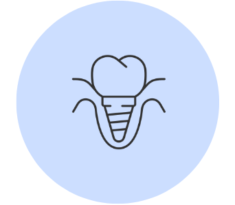 Impantų/ protezų priežiūrai